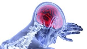 Waspadai Bahaya Sumbatan Otak dan Leher