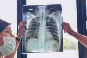 Jenis Rokok Berbeda, Beda Lokasi Kankernya